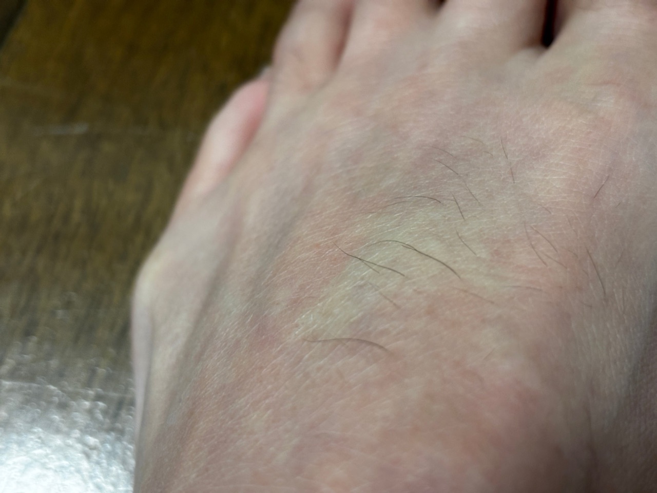 ケノンを当てる前のパパの足の甲。細い毛がぽつぽつ生えている