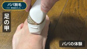 ケノンを足の甲に当てているところ