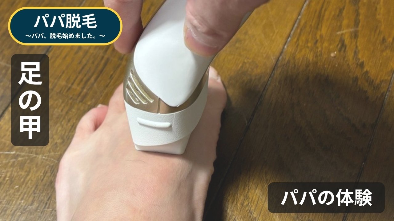 ケノンを足の甲に当てているところ