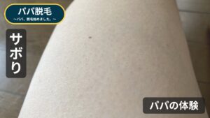ケノンを1か月使わなかったパパの足